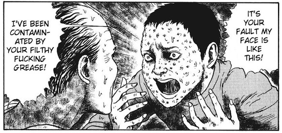 horror manga boy with pocked face
