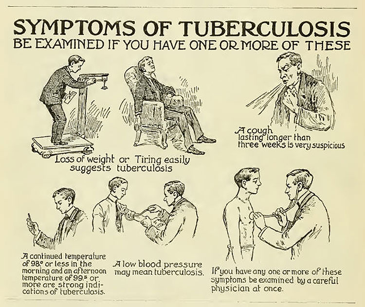 old poster about tuberculosis