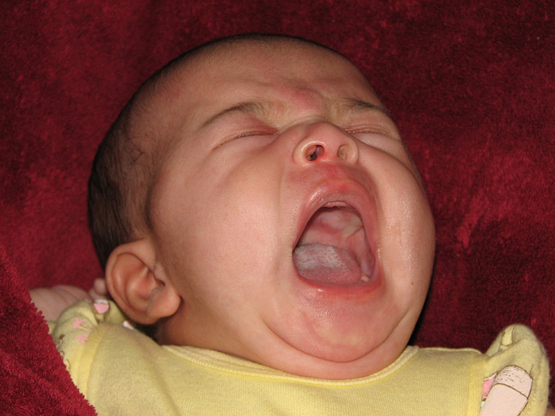 An upset baby screaming